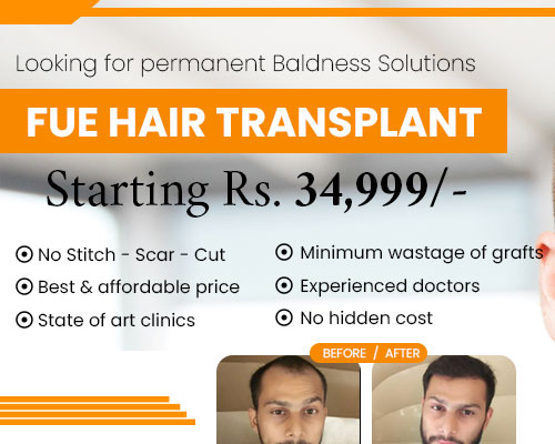 Hair Transplant in Mathura
